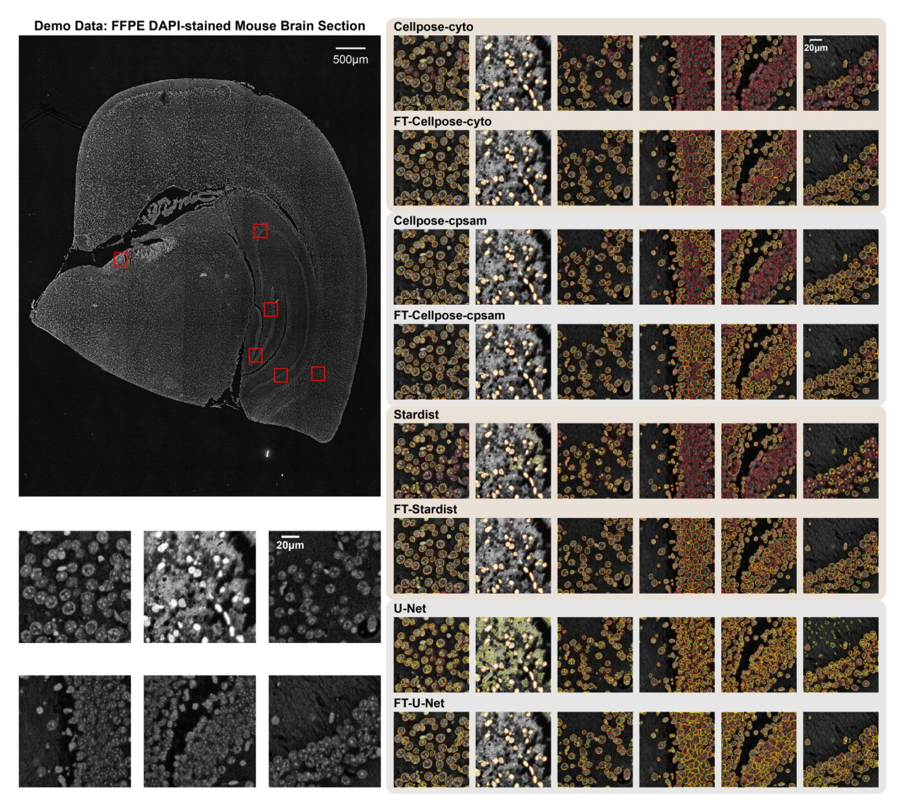 图2. 原始图像与微调前后分割结果示例（红色轮廓表示人工标注的真实区域，黄色轮廓表示模型预测的分割边界。模型名称前缀为“FT-”表示微调权重）